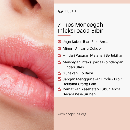Mencegah Infeksi pada Bibir